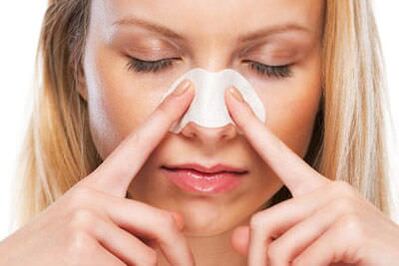 Rinoplasty of the nose