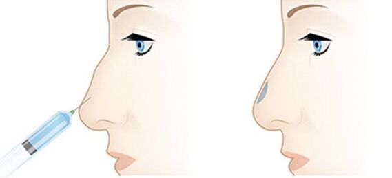 With the procedure you can adapt various problems