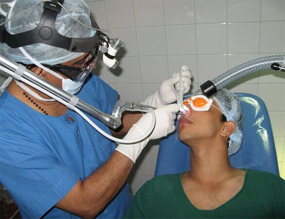Correction of the septum with a laser scalpel