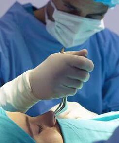 Carrying out closed plastic surgery of the nose
