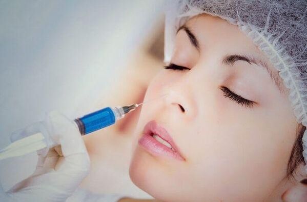Filler injections for rhinoplasty